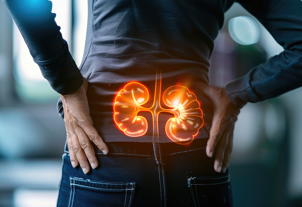 Isenção de Imposto de Renda por Nefropatia Grave: O Direito do Paciente Renal