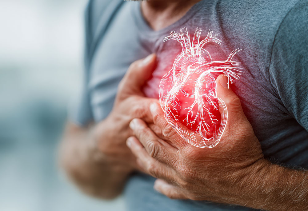 Isenção de Imposto de Renda para Cardiopatia Grave: Quem possui Stent tem direito?